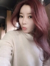 Goodbye button nose! — Korea cost, reviews & before-after | MISOODA