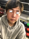 [Contouring Plastic Surgery] I believe it’s the best plastic surgery for men. — Korea cost, reviews & before-after | MISOODA