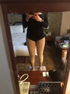 Revision Lower Body Liposuction (Hip, Thighs, Knees, Calves Botox) — Korea cost, reviews & before-after | MISOODA