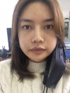 3 type of facial contour surgery — Korea cost, reviews & before-after | MISOODA