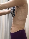 Liposuction and Breast Augmentation — Korea cost, reviews & before-after | MISOODA