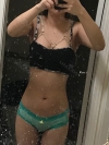 Liposuction and Breast Augmentation — Korea cost, reviews & before-after | MISOODA