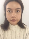 3 type of facial contour surgery — Korea cost, reviews & before-after | MISOODA