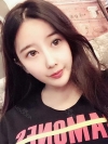 Cheekbone Reduction & V-Line Surgery — Korea cost, reviews & before-after | MISOODA
