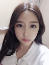 Cheekbone Reduction & V-Line Surgery — Korea cost, reviews & before-after | MISOODA