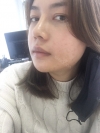 3 type of facial contour surgery — Korea cost, reviews & before-after | MISOODA