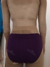 Liposuction and Breast Augmentation — Korea cost, reviews & before-after | MISOODA