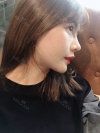 3 type of facial contour surgery — Korea cost, reviews & before-after | MISOODA