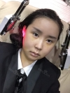 Two jaw surgery in South Korea — Korea cost, reviews & before-after | MISOODA