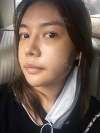 3 type of facial contour surgery — Korea cost, reviews & before-after | MISOODA