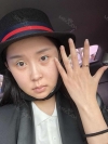 Two jaw surgery in South Korea — Korea cost, reviews & before-after | MISOODA