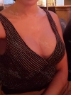 Motiva Breast Surgery at JK — Korea cost, reviews & before-after | MISOODA