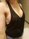 Motiva Breast Surgery at JK — Korea cost, reviews & before-after | MISOODA