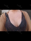 Motiva Breast Surgery at JK — Korea cost, reviews & before-after | MISOODA