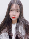 Double Eyelid Revision (Natural adhesion method+Ptosis correction+Dual Epi) + Nasal bridge + Nasal tip — Korea cost, reviews & before-after | MISOODA