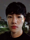 Nasal bridge+Nasal tip surgery / used nasal septum — Korea cost, reviews & before-after | MISOODA