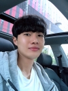 Nasal bridge+Nasal tip surgery / used nasal septum — Korea cost, reviews & before-after | MISOODA