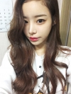 Eye surgery (Natural adhesion+ Ptosis correction) + Nasal bridge+Nasal tip — Korea cost, reviews & before-after | MISOODA