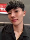 Nasal bridge+Nasal tip surgery / used nasal septum — Korea cost, reviews & before-after | MISOODA
