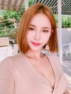 Double Eyelid Revision (Natural adhesion method+Ptosis correction) — Korea cost, reviews & before-after | MISOODA