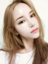 Double Eyelid Revision (Natural adhesion method+Ptosis correction) — Korea cost, reviews & before-after | MISOODA