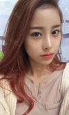 Eye surgery (Natural adhesion+ Ptosis correction) + Nasal bridge+Nasal tip — Korea cost, reviews & before-after | MISOODA
