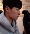 Nasal bridge+Nasal tip surgery / used nasal septum — Korea cost, reviews & before-after | MISOODA