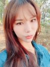 Double Eyelid Revision (Natural adhesion method+Ptosis correction) — Korea cost, reviews & before-after | MISOODA