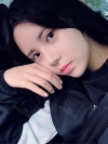 Double Eyelid Revision (Natural adhesion method+Ptosis correction+Dual Epi) + Nasal bridge + Nasal tip — Korea cost, reviews & before-after | MISOODA