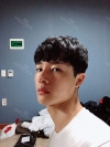 Nasal bridge+Nasal tip surgery / used nasal septum — Korea cost, reviews & before-after | MISOODA