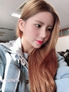 Double Eyelid Revision (Natural adhesion method+Ptosis correction+Dual Epi) + Nasal bridge + Nasal tip — Korea cost, reviews & before-after | MISOODA