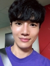 Nasal bridge+Nasal tip surgery / used nasal septum — Korea cost, reviews & before-after | MISOODA