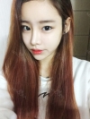 Eye surgery (Natural adhesion+ Ptosis correction) + Nasal bridge+Nasal tip — Korea cost, reviews & before-after | MISOODA