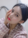 Double Eyelid Revision (Natural adhesion method+Ptosis correction+Dual Epi) + Nasal bridge + Nasal tip — Korea cost, reviews & before-after | MISOODA
