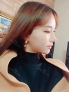 Double Eyelid Revision (Natural adhesion method+Ptosis correction) — Korea cost, reviews & before-after | MISOODA