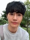 Nasal bridge+Nasal tip surgery / used nasal septum — Korea cost, reviews & before-after | MISOODA