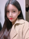 Double Eyelid Revision (Natural adhesion method+Ptosis correction+Dual Epi) + Nasal bridge + Nasal tip — Korea cost, reviews & before-after | MISOODA