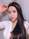 Double Eyelid Revision (Natural adhesion method+Ptosis correction+Dual Epi) + Nasal bridge + Nasal tip — Korea cost, reviews & before-after | MISOODA