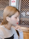 Double Eyelid Revision (Natural adhesion method+Ptosis correction+Dual Epi) + Nasal bridge + Nasal tip — Korea cost, reviews & before-after | MISOODA