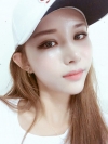 Double Eyelid Revision (Natural adhesion method+Ptosis correction) — Korea cost, reviews & before-after | MISOODA