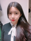 Double Eyelid Revision (Natural adhesion method+Ptosis correction+Dual Epi) + Nasal bridge + Nasal tip — Korea cost, reviews & before-after | MISOODA