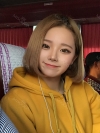 Dual Epi + Nasap Tip Correction + Lip Filler — Korea cost, reviews & before-after | MISOODA