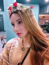 Double Eyelid Revision (Natural adhesion method+Ptosis correction+Dual Epi) + Nasal bridge + Nasal tip — Korea cost, reviews & before-after | MISOODA