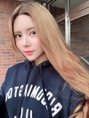 Double Eyelid Revision (Natural adhesion method+Ptosis correction+Dual Epi) + Nasal bridge + Nasal tip — Korea cost, reviews & before-after | MISOODA