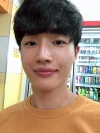Nasal bridge+Nasal tip surgery / used nasal septum — Korea cost, reviews & before-after | MISOODA