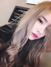 Eye surgery (Natural adhesion+ Ptosis correction) + Nasal bridge+Nasal tip — Korea cost, reviews & before-after | MISOODA