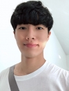 Nasal bridge+Nasal tip surgery / used nasal septum — Korea cost, reviews & before-after | MISOODA