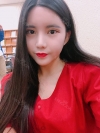 Double Eyelid Revision (Natural adhesion method+Ptosis correction+Dual Epi) + Nasal bridge + Nasal tip — Korea cost, reviews & before-after | MISOODA