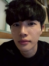 Nasal bridge+Nasal tip surgery / used nasal septum — Korea cost, reviews & before-after | MISOODA