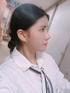 Double Eyelid Revision (Natural adhesion method+Ptosis correction+Dual Epi) + Nasal bridge + Nasal tip — Korea cost, reviews & before-after | MISOODA